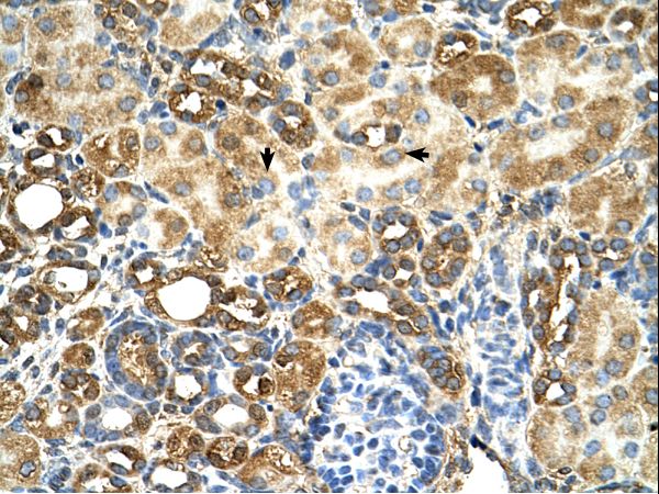 TAMM41 / C3orf31 Antibody - C3orf31 antibody C3ORF31 Antibody was used in IHC to stain formalin-fixed, paraffin-embedded human kidney.  This image was taken for the unconjugated form of this product. Other forms have not been tested.
