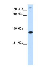 TAMM41 / C3orf31 Antibody - HepG2 cell lysate. Antibody concentration: 2.5 ug/ml. Gel concentration: 12%.  This image was taken for the unconjugated form of this product. Other forms have not been tested.