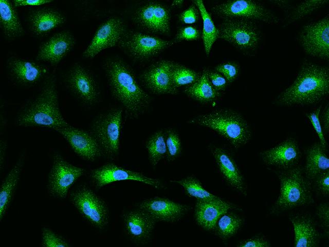 TANGO / MIA3 Antibody - Immunofluorescence staining of MIA3 in A549 cells. Cells were fixed with 4% PFA, permeabilzed with 0.1% Triton X-100 in PBS, blocked with 10% serum, and incubated with rabbit anti-Human MIA3 polyclonal antibody (dilution ratio 1:200) at 4°C overnight. Then cells were stained with the Alexa Fluor 488-conjugated Goat Anti-rabbit IgG secondary antibody (green) and counterstained with DAPI (blue). Positive staining was localized to Cytoplasm.