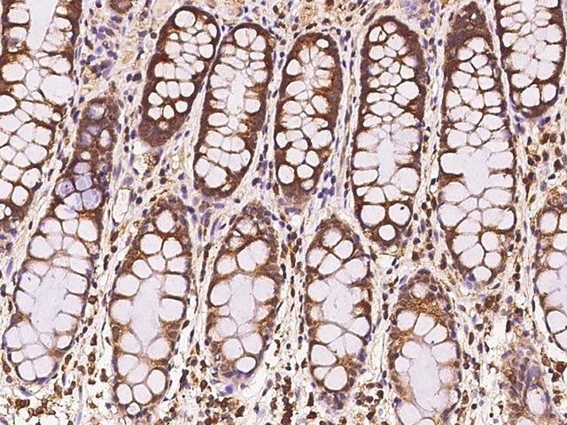 TANGO / MIA3 Antibody - Immunochemical staining of human MIA3 in human rectum with rabbit polyclonal antibody at 1:100 dilution, formalin-fixed paraffin embedded sections.