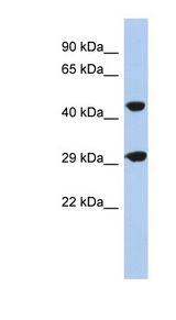 TANGO2 / C22orf25 Antibody - C22orf25 antibody Western blot of Fetal Muscle lysate. This image was taken for the unconjugated form of this product. Other forms have not been tested.