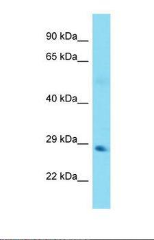 TANK Antibody - Western blot of Human Lung Tumor. TANK antibody dilution 1.0 ug/ml.  This image was taken for the unconjugated form of this product. Other forms have not been tested.