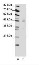 TANK Antibody - A: Marker, B: Jurkat Cell Lysate.  This image was taken for the unconjugated form of this product. Other forms have not been tested.