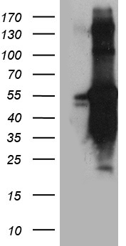 TANK Antibody - HEK293T cells were transfected with the pCMV6-ENTRY control. (Left lane) or pCMV6-ENTRY TANK. (Right lane) cDNA for 48 hrs and lysed