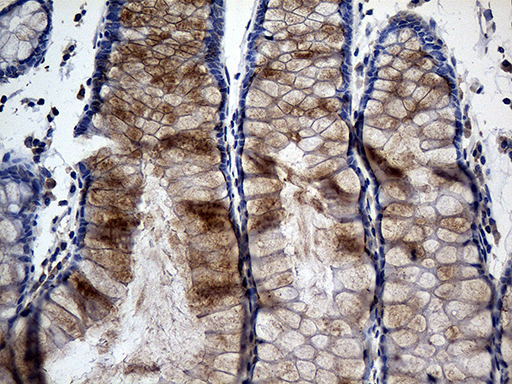 TANK Antibody - Immunohistochemical staining of paraffin-embedded Human colon tissue within the normal limits using anti-TANK mouse monoclonal antibody. (Heat-induced epitope retrieval by 1mM EDTA in 10mM Tris buffer. (pH8.5) at 120°C for 3 min. (1:500)