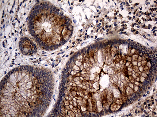 TANK Antibody - Immunohistochemical staining of paraffin-embedded Human appendix tissue within the normal limits using anti-TANK mouse monoclonal antibody. (Heat-induced epitope retrieval by 1mM EDTA in 10mM Tris buffer. (pH8.5) at 120°C for 3 min. (1:500)