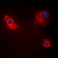 TANK Antibody - Immunofluorescent analysis of TANK staining in HeLa cells. Formalin-fixed cells were permeabilized with 0.1% Triton X-100 in TBS for 5-10 minutes and blocked with 3% BSA-PBS for 30 minutes at room temperature. Cells were probed with the primary antibody in 3% BSA-PBS and incubated overnight at 4 C in a humidified chamber. Cells were washed with PBST and incubated with a DyLight 594-conjugated secondary antibody (red) in PBS at room temperature in the dark. DAPI was used to stain the cell nuclei (blue).