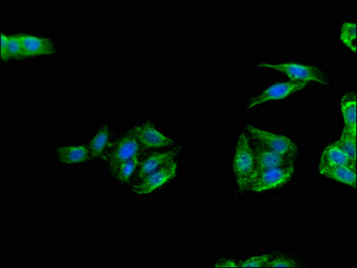 TANK Antibody - Immunofluorescent analysis of HepG2 cells using TANK Antibody at a dilution of 1:100 and Alexa Fluor 488-congugated AffiniPure Goat Anti-Rabbit IgG(H+L)