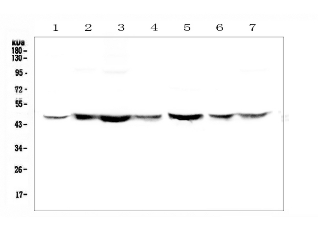 TANK Antibody - Western blot analysis of TANK using anti-TANK antibody. Electrophoresis was performed on a 5-20% SDS-PAGE gel at 70V (Stacking gel) / 90V (Resolving gel) for 2-3 hours. The sample well of each lane was loaded with 50ug of sample under reducing conditions. Lane 1: human Hela whole cell lysate,Lane 2: human placenta tissue lysates,Lane 3: human A549 whole cell lysate,Lane 4: human MDA-MB-453 whole cell lysate,Lane 5: human SW620 whole cell lysate,Lane 6: human 22RV1 whole cell lysate,Lane 7: human SW579 whole cell lysate. After Electrophoresis, proteins were transferred to a Nitrocellulose membrane at 150mA for 50-90 minutes. Blocked the membrane with 5% Non-fat Milk/ TBS for 1.5 hour at RT. The membrane was incubated with rabbit anti-TANK antigen affinity purified polyclonal antibody at 0.5 µg/mL overnight at 4°C, then washed with TBS-0.1% Tween 3 times with 5 minutes each and probed with a goat anti-rabbit IgG-HRP secondary antibody at a dilution of 1:10000 for 1.5 hour at RT. The signal is developed using an Enhanced Chemiluminescent detection (ECL) kit with Tanon 5200 system. A specific band was detected for TANK at approximately 48KD. The expected band size for TANK is at 48KD.