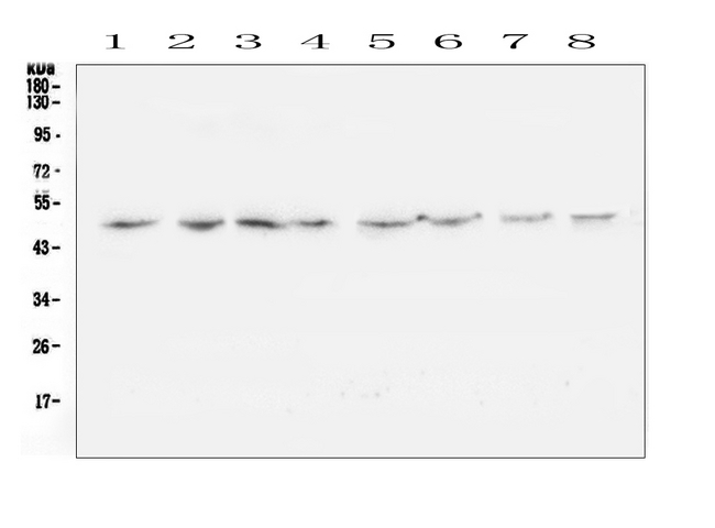 TANK Antibody - Western blot analysis of TANK using anti-TANK antibody. Electrophoresis was performed on a 5-20% SDS-PAGE gel at 70V (Stacking gel) / 90V (Resolving gel) for 2-3 hours. The sample well of each lane was loaded with 50ug of sample under reducing conditions. Lane 1: rat brain tissue lysates,Lane 2: rat lung tissue lysates,Lane 3: rat spleen tissue lysates,Lane 4: rat kidney tissue lysates,Lane 5: mouse brain tissue lysates,Lane 6: mouse lung tissue lysates,Lane 7: mouse spleen tissue lysates,Lane 8: mouse kidney tissue lysates. After Electrophoresis, proteins were transferred to a Nitrocellulose membrane at 150mA for 50-90 minutes. Blocked the membrane with 5% Non-fat Milk/ TBS for 1.5 hour at RT. The membrane was incubated with rabbit anti-TANK antigen affinity purified polyclonal antibody at 0.5 µg/mL overnight at 4°C, then washed with TBS-0.1% Tween 3 times with 5 minutes each and probed with a goat anti-rabbit IgG-HRP secondary antibody at a dilution of 1:10000 for 1.5 hour at RT. The signal is developed using an Enhanced Chemiluminescent detection (ECL) kit with Tanon 5200 system. A specific band was detected for TANK at approximately 48KD. The expected band size for TANK is at 48KD.