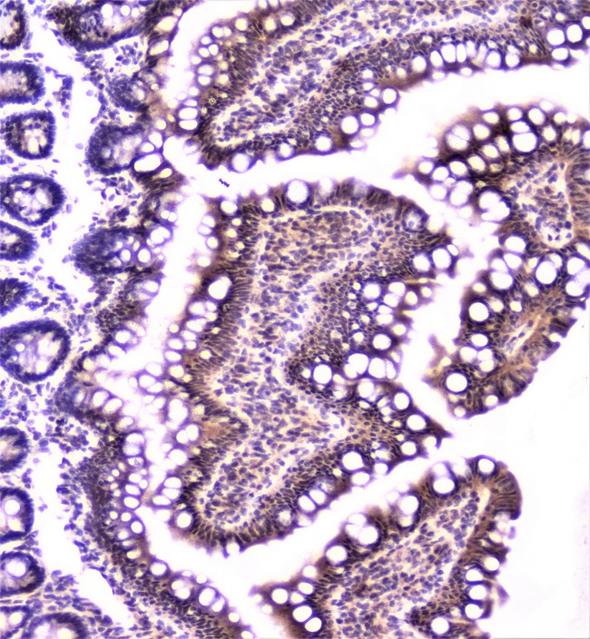 TANK Antibody - IHC analysis of TANK using anti-TANK antibody. TANK was detected in paraffin-embedded section of rat small intestine tissue. Heat mediated antigen retrieval was performed in citrate buffer (pH6, epitope retrieval solution) for 20 mins. The tissue section was blocked with 10% goat serum. The tissue section was then incubated with 1µg/ml rabbit anti-TANK Antibody overnight at 4°C. Biotinylated goat anti-rabbit IgG was used as secondary antibody and incubated for 30 minutes at 37°C. The tissue section was developed using Strepavidin-Biotin-Complex (SABC) with DAB as the chromogen.