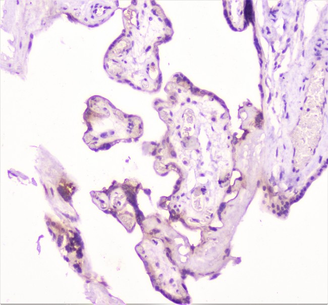 TANK Antibody - IHC analysis of TANK using anti-TANK antibody. TANK was detected in paraffin-embedded section of human placenta tissue. Heat mediated antigen retrieval was performed in citrate buffer (pH6, epitope retrieval solution) for 20 mins. The tissue section was blocked with 10% goat serum. The tissue section was then incubated with 1µg/ml rabbit anti-TANK Antibody overnight at 4°C. Biotinylated goat anti-rabbit IgG was used as secondary antibody and incubated for 30 minutes at 37°C. The tissue section was developed using Strepavidin-Biotin-Complex (SABC) with DAB as the chromogen.