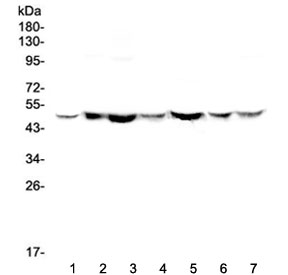 TANK Antibody - Western blot testing of human 1) HeLa, 2) placenta, 3) A549, 4) MDA-MB-453, 5) SW620, 6) 22RV1 and 7) SW579 with TANK antibody at 0.5ug/ml. Expected molecular weight ~48 kDa.