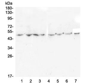 TANK Antibody - Western blot testing of 1) rat brain, 2) rat lung, 3) rat spleen, 4) rat kidney, 5) mouse brain, 6) mouse lung, 7) mouse spleen and 8) mouse kidney with TANK antibody at 0.5ug/ml. Expected molecular weight ~48 kDa.