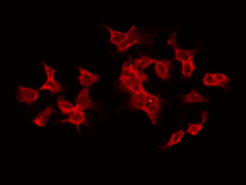 TANK Antibody - Staining HT29 cells by IF/ICC. The samples were fixed with PFA and permeabilized in 0.1% Triton X-100, then blocked in 10% serum for 45 min at 25°C. The primary antibody was diluted at 1:200 and incubated with the sample for 1 hour at 37°C. An Alexa Fluor 594 conjugated goat anti-rabbit IgG (H+L) Ab, diluted at 1/600, was used as the secondary antibody.