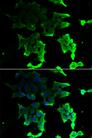 TANK Antibody - Immunofluorescence analysis of HeLa cells using TANK Polyclonal Antibody.