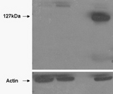 TANK2 / TNKS2 Antibody - HEK293 overexpressing TANK2 (lane 4) and TANK1 (lane 2) and probed with (mock transfection in first lane). Lane three is empty. Lower panel shows the same lysates probed for alpha-Actin to show protein levels. Primary incubation (0.5ug/ml) was ove