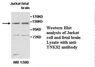 TANK2 / TNKS2 Antibody