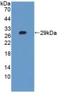 TANK2 / TNKS2 Antibody - Western Blot; Sample: Recombinant TNKS2, Human.