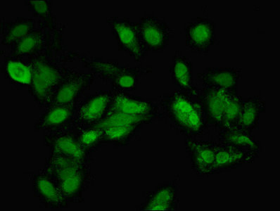 TANK2 / TNKS2 Antibody - Immunofluorescent analysis of Hela cells diluted at 1:100 and Alexa Fluor 488-congugated AffiniPure Goat Anti-Rabbit IgG(H+L)