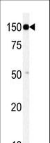 TAOK1 / TAO1 Antibody - Western blot of anti-TAOK1 antibody in mouse brain tissue lysate (35 ug/lane). TAOK1(arrow) was detected using the purified antibody.