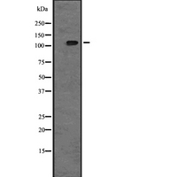 TAOK2 / TAO2 Antibody - Western blot analysis of TAOK2 expression in A431 whole cells lysate. The lane on the left is treated with the antigen-specific peptide.