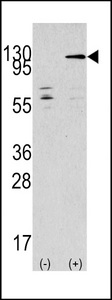 TAOK3 / JIK Antibody - Western blot of TAOK3 (arrow) using rabbit polyclonal TAOK3 Antibody. 293 cell lysates (2 ug/lane) either nontransfected (Lane 1) or transiently transfected with the TAOK3 gene (Lane 2) (Origene Technologies).