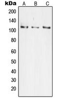 TAOK3 / JIK Antibody - Western blot analysis of JIK expression in HeLa (A); Jurkat (B); HEK293 (C) whole cell lysates.