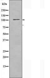 TAOK3 / JIK Antibody - Western blot analysis of extracts of K562 cells using TAOK3 antibody.