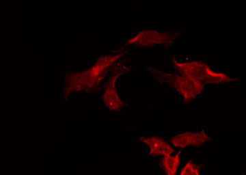 TAOK3 / JIK Antibody - Staining HeLa cells by IF/ICC. The samples were fixed with PFA and permeabilized in 0.1% Triton X-100, then blocked in 10% serum for 45 min at 25°C. The primary antibody was diluted at 1:200 and incubated with the sample for 1 hour at 37°C. An Alexa Fluor 594 conjugated goat anti-rabbit IgG (H+L) Ab, diluted at 1/600, was used as the secondary antibody.