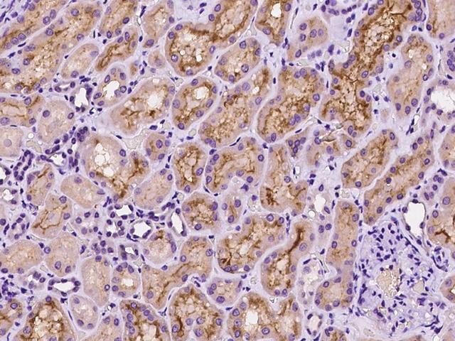 TAOK3 / JIK Antibody - Immunochemical staining of human TAOK3 in human kidney with rabbit polyclonal antibody at 1:100 dilution, formalin-fixed paraffin embedded sections.