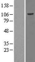 TAOK3 / JIK Protein - Western validation with an anti-DDK antibody * L: Control HEK293 lysate R: Over-expression lysate