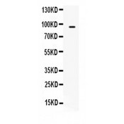 TAP2 Antibody - TAP2 antibody Western blot. All lanes: Anti TAP2 at 0.5 ug/ml. WB: HELA Whole Cell Lysate at 40 ug. Predicted band size: 87 kD. Observed band size: 87 kD.