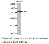 TAP2 Antibody - Western blot.