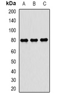 TAP2 Antibody - Western blot analysis of TAP2 expression in MCF7 (A); mouse spleen (B); mouse lung (C) whole cell lysates.
