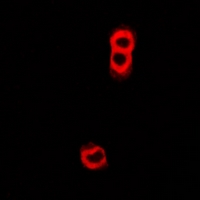 TAP2 Antibody - Immunofluorescent analysis of TAP2 staining in U2OS cells. Formalin-fixed cells were permeabilized with 0.1% Triton X-100 in TBS for 5-10 minutes and blocked with 3% BSA-PBS for 30 minutes at room temperature. Cells were probed with the primary antibody in 3% BSA-PBS and incubated overnight at 4 deg C in a humidified chamber. Cells were washed with PBST and incubated with a DyLight 594-conjugated secondary antibody (red) in PBS at room temperature in the dark.
