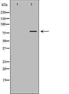 TAP2 Antibody - Western blot analysis of extracts of placenta using TAP2 antibody. The lane on the left is treated with the antigen-specific peptide.