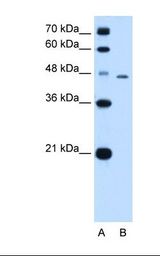 TAPBP / Tapasin Antibody - Lane A: Marker. Lane B: HepG2 cell lysate. Antibody concentration: 0.5 ug/ml. Gel concentration: 12%.  This image was taken for the unconjugated form of this product. Other forms have not been tested.