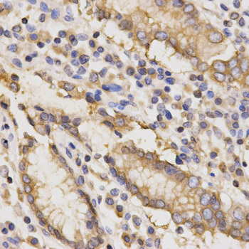 TAPBP / Tapasin Antibody - Immunohistochemistry of paraffin-embedded human stomach using TAPBP antibody at dilution of 1:200 (x400 lens)