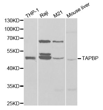 TAPBP / Tapasin Antibody - Western blot analysis of extracts of various cell lines, using TAPBP antibody at 1:1000 dilution. The secondary antibody used was an HRP Goat Anti-Rabbit IgG (H+L) at 1:10000 dilution. Lysates were loaded 25ug per lane and 3% nonfat dry milk in TBST was used for blocking.