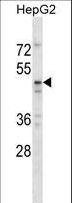 TAPBPL / TAPBPR Antibody - TAPBPL Antibody western blot of HepG2 cell line lysates (35 ug/lane). The TAPBPL antibody detected the TAPBPL protein (arrow).