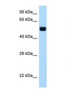 TAPBPL / TAPBPR Antibody - TAPBPL antibody Western blot of Mouse Brain lysate. Antibody concentration 1 ug/ml.  This image was taken for the unconjugated form of this product. Other forms have not been tested.