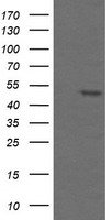TAPBPL / TAPBPR Antibody - HEK293T cells were transfected with the pCMV6-ENTRY control (Left lane) or pCMV6-ENTRY TAPBPL (Right lane) cDNA for 48 hrs and lysed. Equivalent amounts of cell lysates (5 ug per lane) were separated by SDS-PAGE and immunoblotted with anti-TAPBPL.