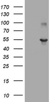 TAPBPL / TAPBPR Antibody - HEK293T cells were transfected with the pCMV6-ENTRY control (Left lane) or pCMV6-ENTRY TAPBPL (Right lane) cDNA for 48 hrs and lysed. Equivalent amounts of cell lysates (5 ug per lane) were separated by SDS-PAGE and immunoblotted with anti-TAPBPL.