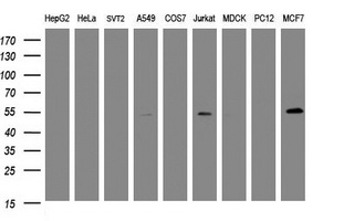 TAPBPL / TAPBPR Antibody - Western blot of extracts (35 ug) from 9 different cell lines by using g anti-TAPBPL monoclonal antibody (HepG2: human; HeLa: human; SVT2: mouse; A549: human; COS7: monkey; Jurkat: human; MDCK: canine; PC12: rat; MCF7: human).