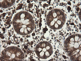 TAPBPL / TAPBPR Antibody - IHC of paraffin-embedded Human colon tissue using anti-TAPBPL mouse monoclonal antibody.
