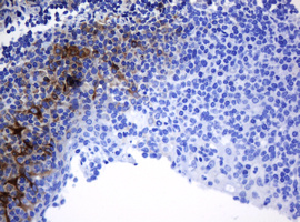 TAPBPL / TAPBPR Antibody - IHC of paraffin-embedded Human tonsil using anti-TAPBPL mouse monoclonal antibody. (Heat-induced epitope retrieval by 10mM citric buffer, pH6.0, 120°C for 3min).