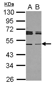 TAPBPL / TAPBPR Antibody - Sample (30 ug of whole cell lysate) A: 293T B: A431 10% SDS PAGE TAPBPL antibody diluted at 1:1000