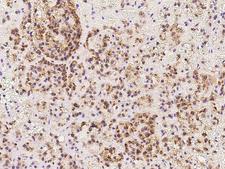 TAPT1 Antibody - Immunochemical staining of human TAPT1 in human adrenal gland with rabbit polyclonal antibody at 1:100 dilution, formalin-fixed paraffin embedded sections.