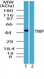 TARBP2 / TRBP2 Antibody - Western blot of TRBP in human brain lysate in the 1) absence, 2) presence of immunizing peptide using antibody at 6 ug/ml.